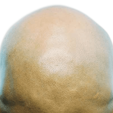 BALD token